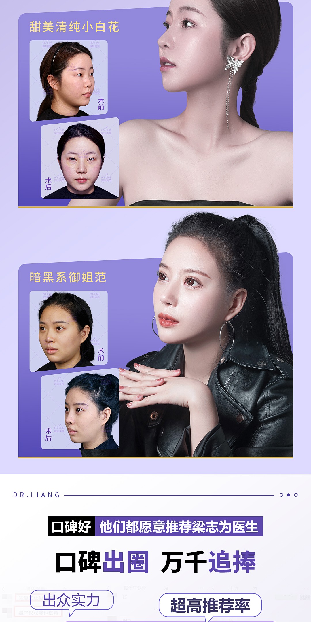 梁志为-眼吸脂3