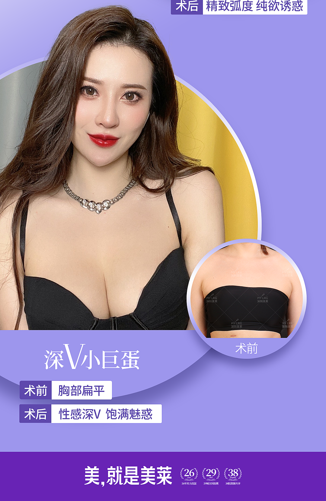 郭杰-吸脂微拉美6